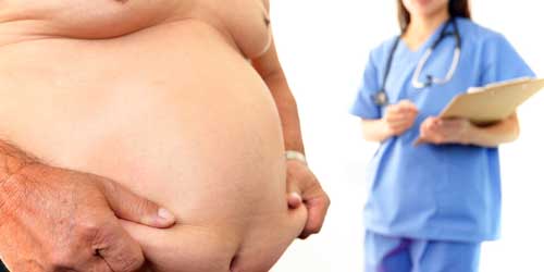 肥満の原因｜内臓脂肪と病気のリスク